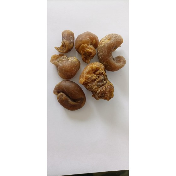 Chicken Gallstone